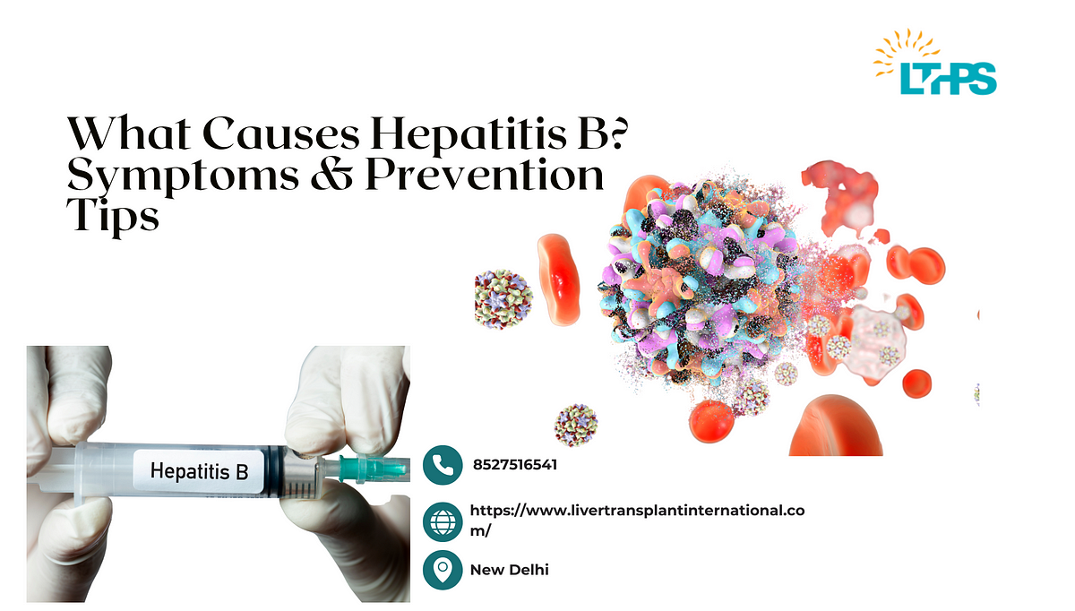 What Causes Hepatitis B? Symptoms & Prevention Tips | by Transplantationliver | May, 2025 | Medium