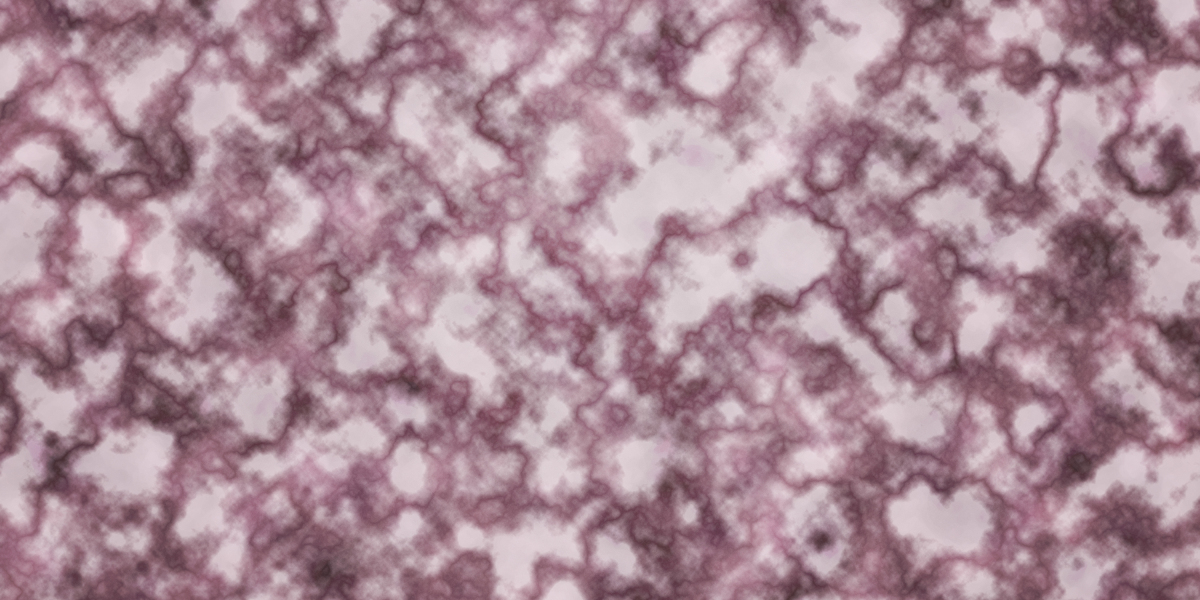 Case Research: The Market for Modafinil In Poland
